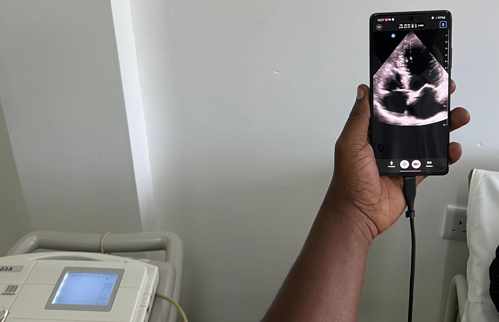 A phone shows an echocardiogram image beside a portable ECG machine