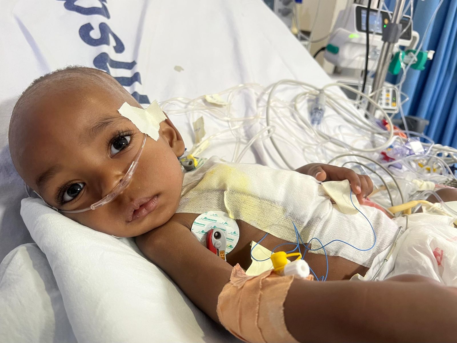 A child in intensive care with monitoring leads after heart surgery